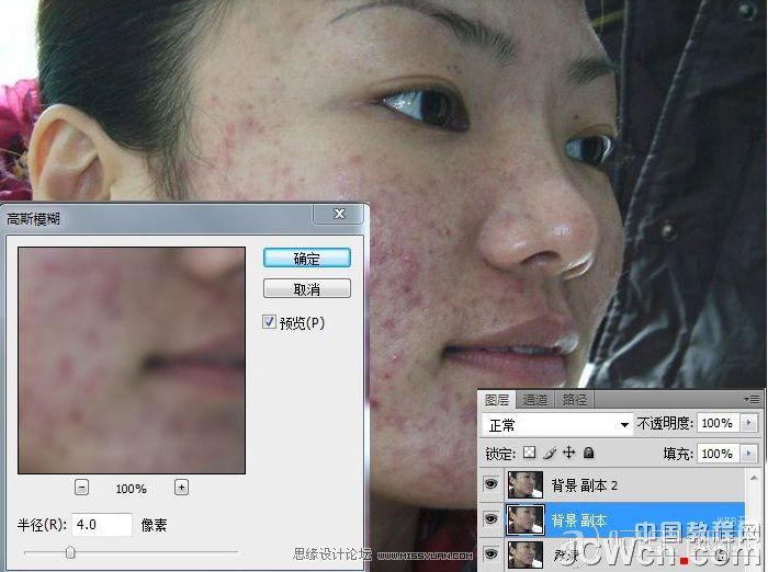 Photoshop高低频法磨皮:处理难磨的图_webjx.com